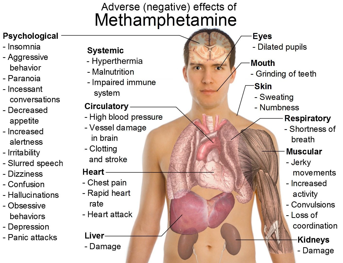 What Is Amphetamine? Uses, Side Effects, Treatment - Rehab Guide