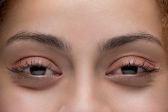 stoned eyes