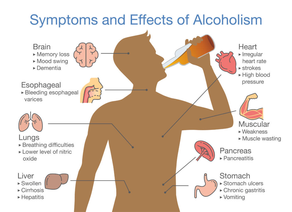 effects of drinking alcohol every day infographic