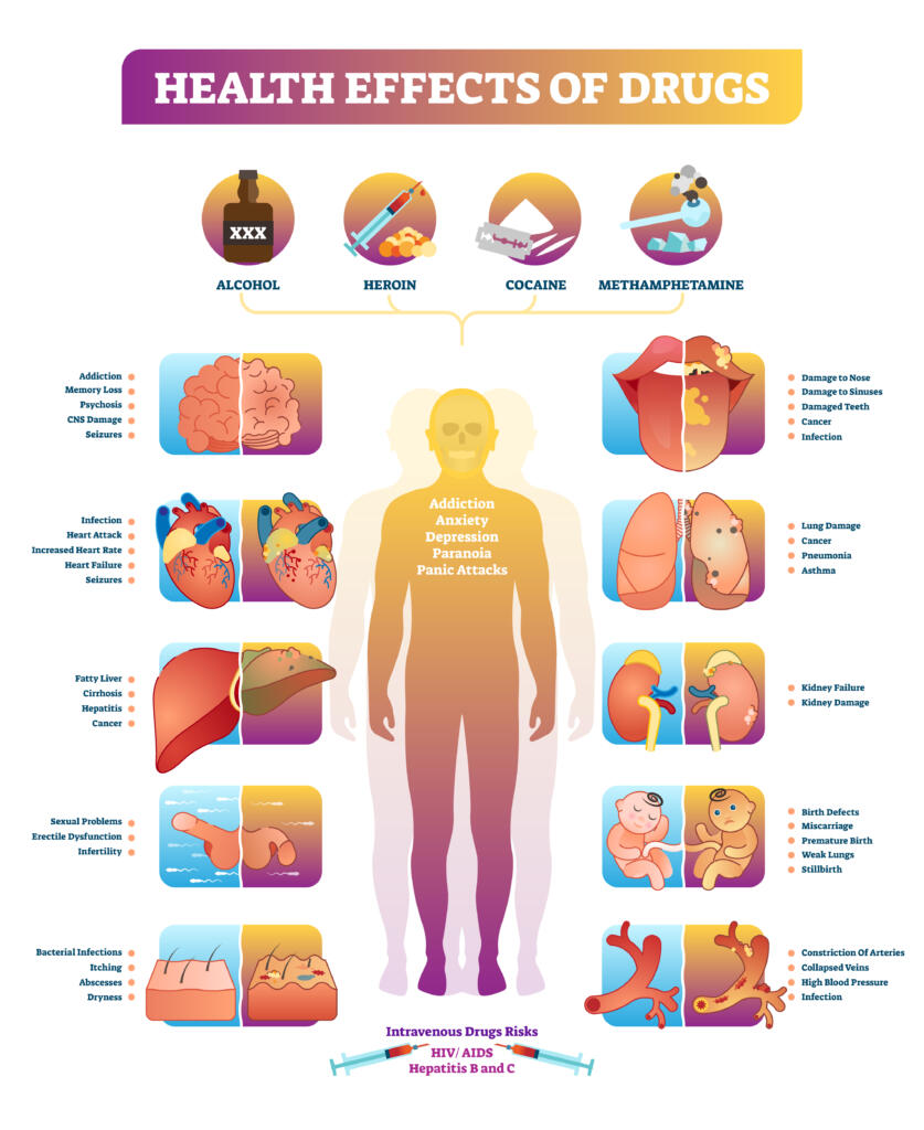 Cocaine Psychosis Rehab Guide cocaine-psychosis-rehab-guide