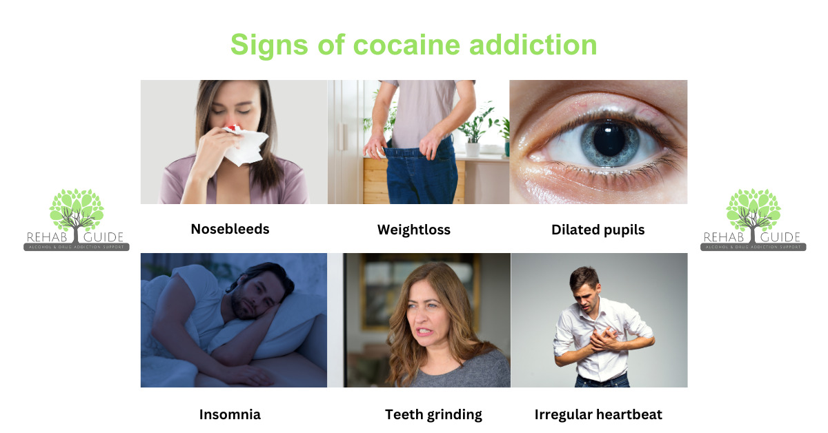 Signs of cocaine addiction gallery showing symptoms with pictures of nosebleeds weightloss insomnia irregular heartbeat dialated pupils and teeth grinding