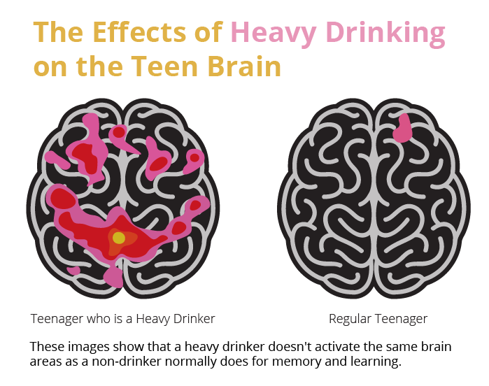 Effects of alcohol on teen brain activity comparison