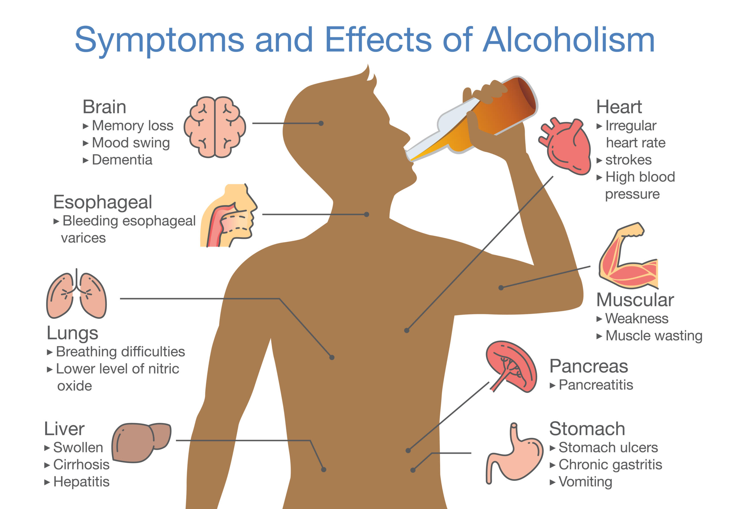 Image showing symptoms and health effects of alcoholism on the body