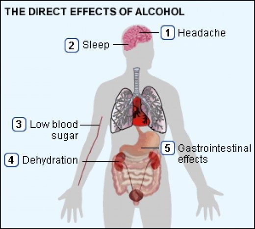 Diagram showing hangover shakes and alcohol effects like headache, dehydration.